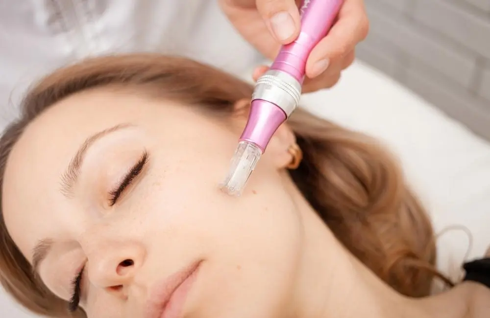 How Much is Microneedling